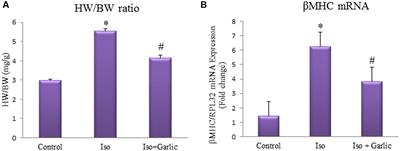 Novel Sulfur Metabolites of Garlic Attenuate Cardiac Hypertrophy and Remodeling through Induction of <mark class="highlighted">Na+/K+-ATPase</mark> Expression
